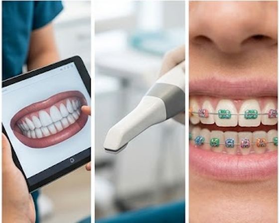 Digital tooth scan, intraoral scanner, and colorful braces